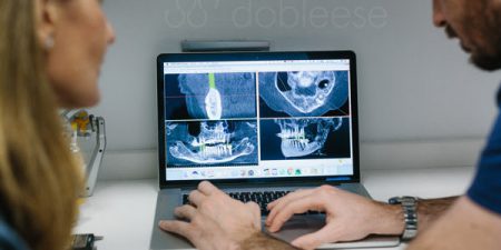 implantes dentales proceso paso a paso