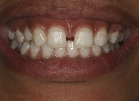 ortodoncia-sevilla-triana