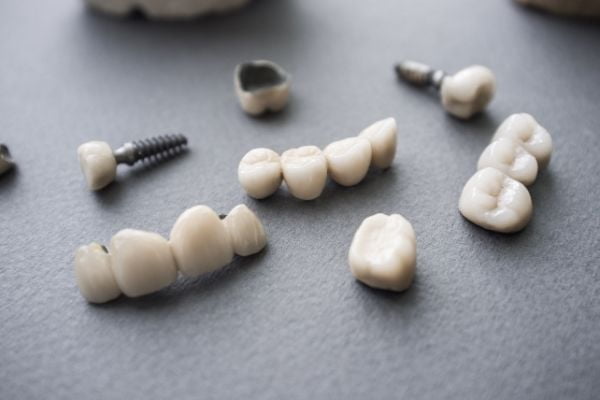 Poner dientes sin implantes alternativas al implante