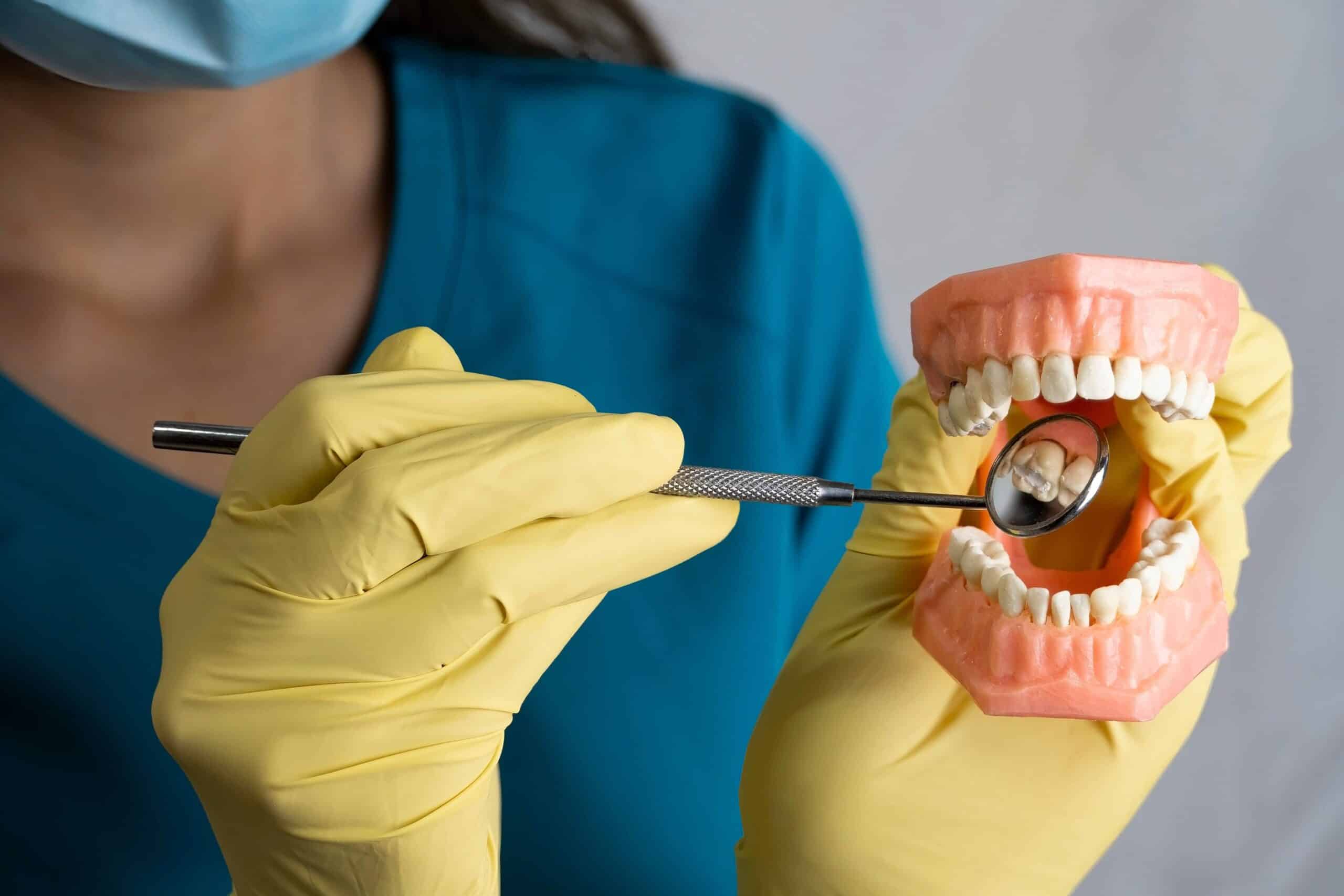 caries leve como eliminar caries leve