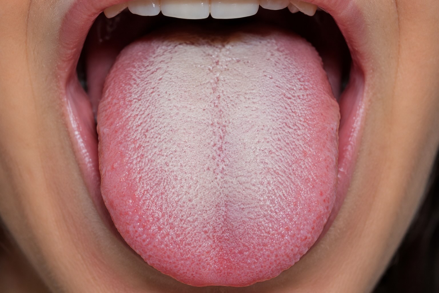 lengua blanca
