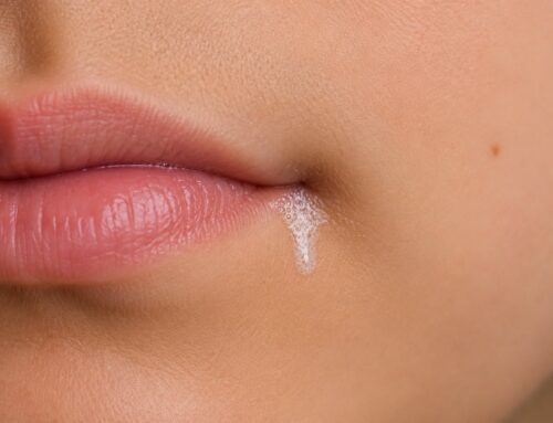 Saliva blanca en los labios o comisuras: causas y soluciones