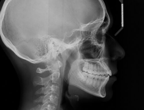Telerradiografía dental: qué es y para qué sirve