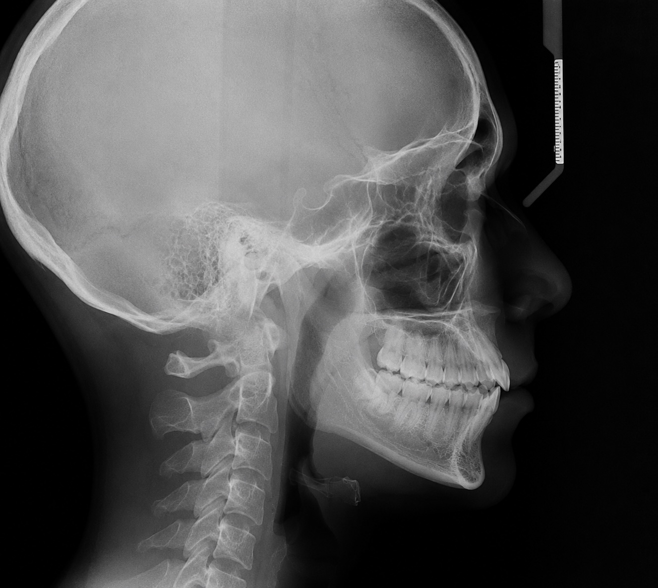 telerradiografía dental