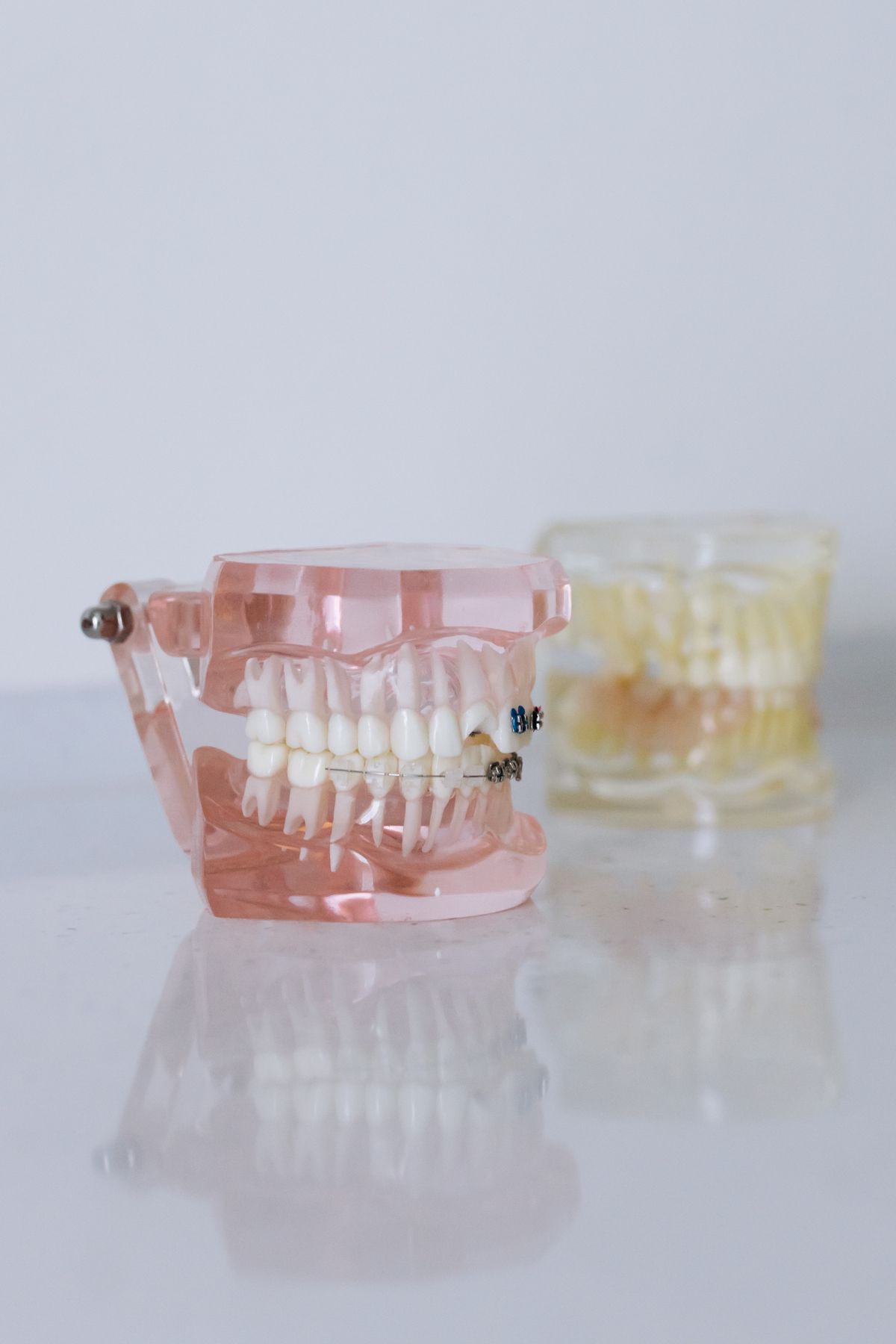 Modelo dental con ortodoncia estética