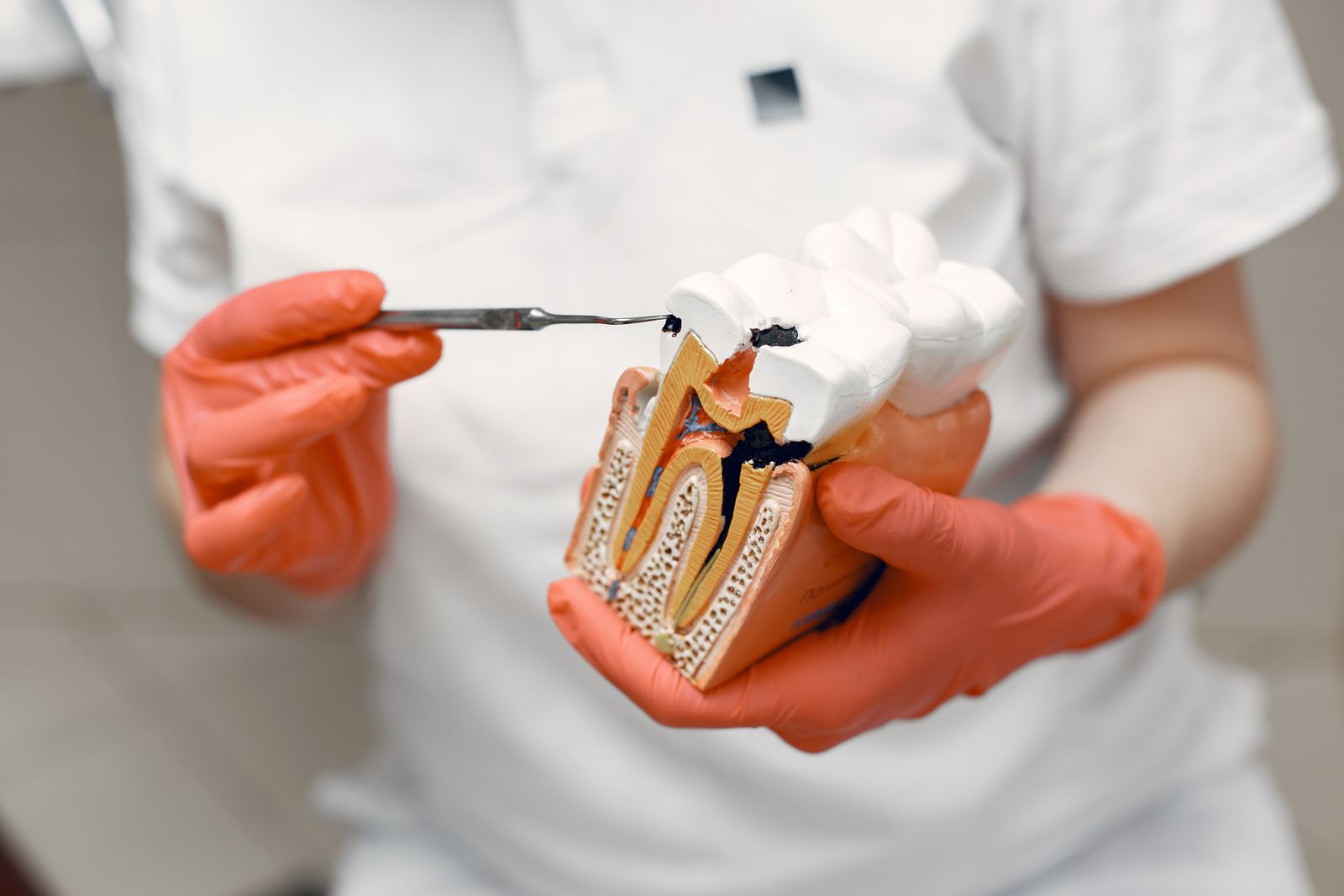 Modelo de diente que muestra la pulpa dental